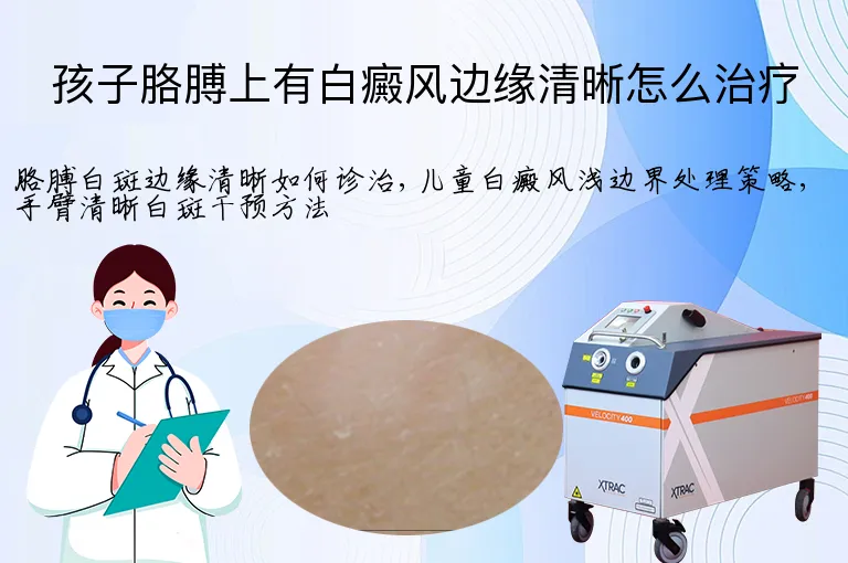 孩子胳膊上有白癜风边缘清晰怎么治疗