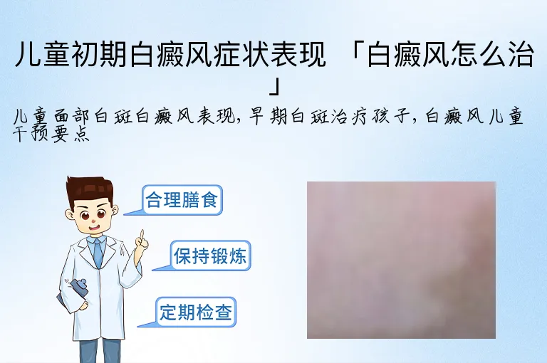 儿童初期白癜风症状表现 「白癜风怎么治」