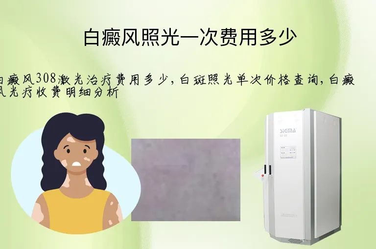 白癜风照光一次费用多少