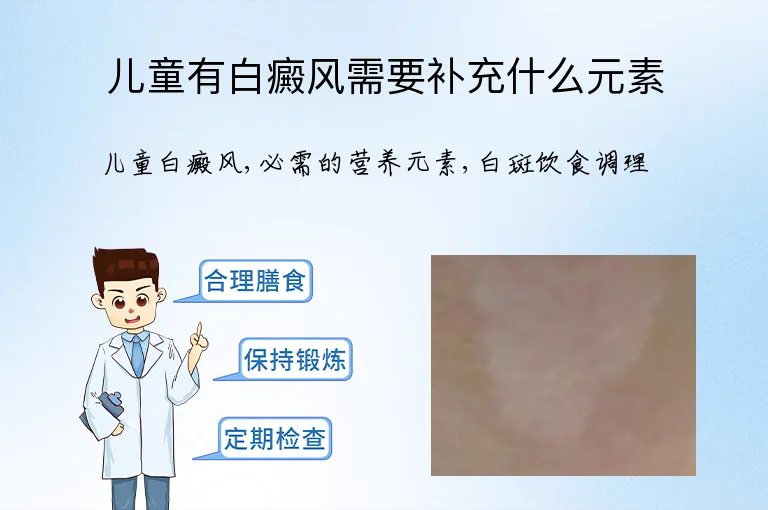 儿童有白癜风需要补充什么元素