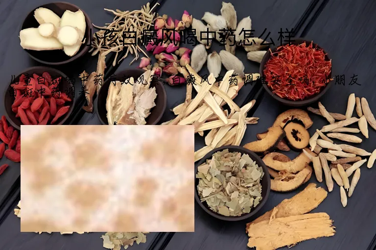 小孩白癜风喝中药怎么样