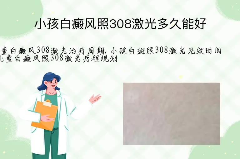 小孩白癜风照308激光多久能好