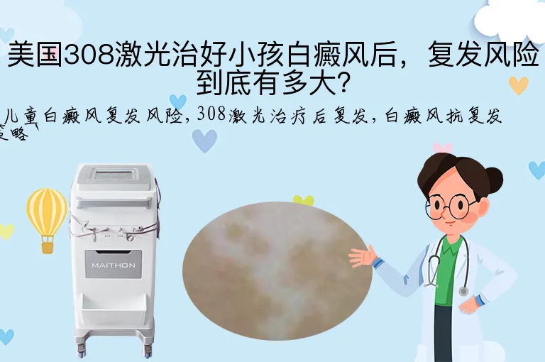 美国308激光治好小孩白癜风后,复发风险到底有多大?