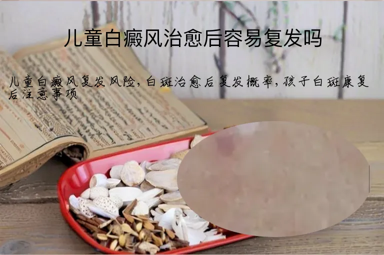 儿童白癜风治愈后容易复发吗