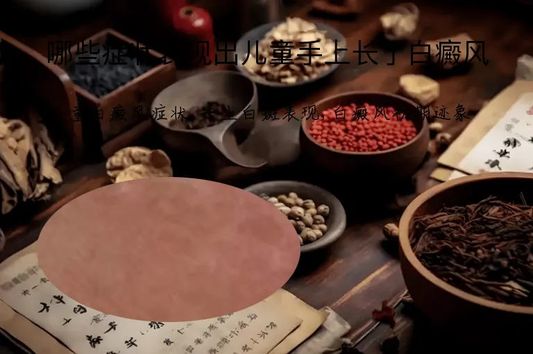 哪些症状表现出儿童手上长了白癜风
