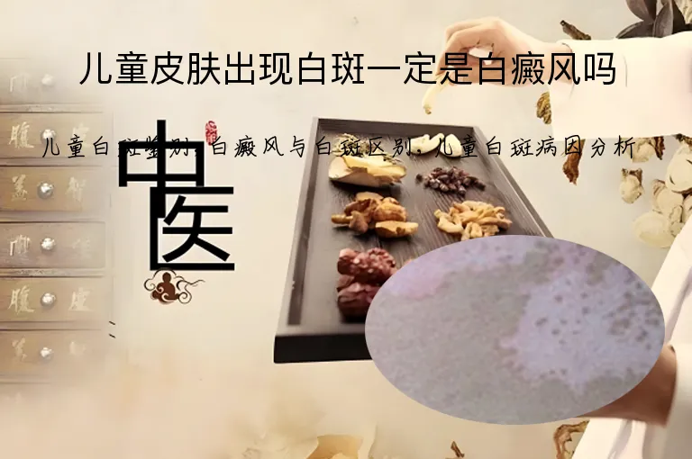 儿童皮肤出现白斑一定是白癜风吗