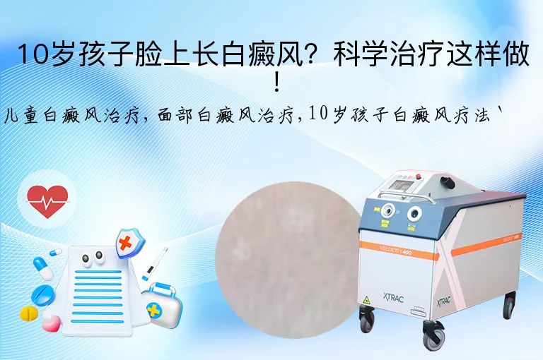 10岁孩子脸上长白癜风？科学治疗这样做！