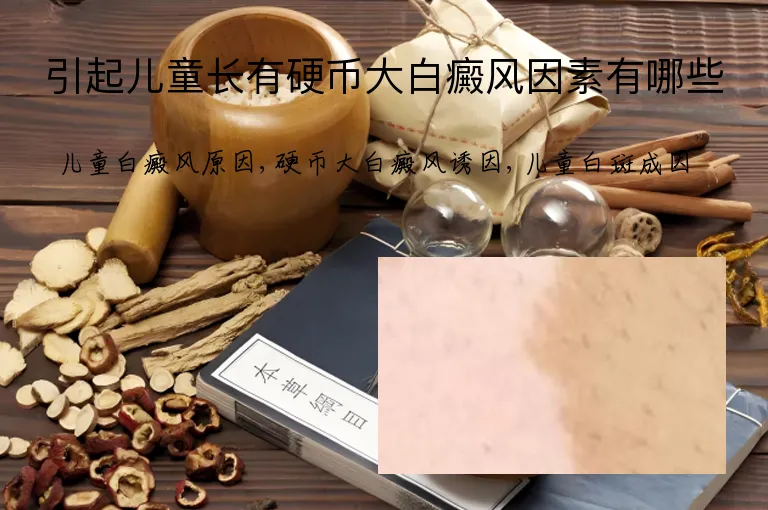 引起儿童长有硬币大白癜风因素有哪些