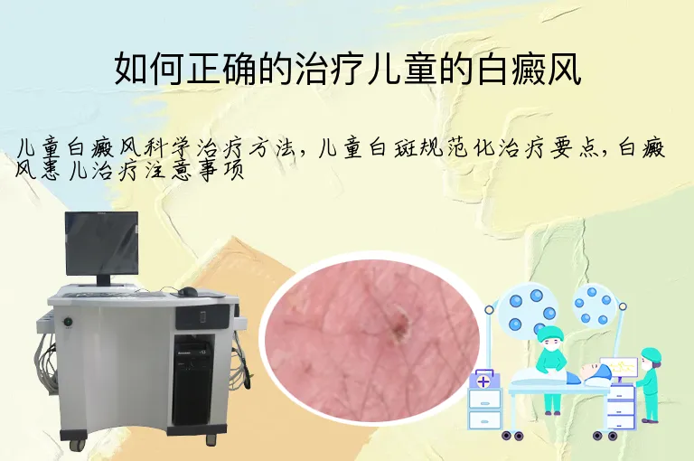 如何正确的治疗儿童的白癜风