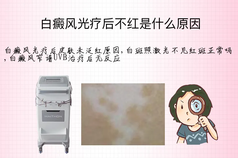 白癜风光疗后不红是什么原因