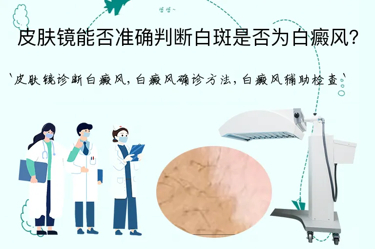 皮肤镜能否准确判断白斑是否为白癜风？