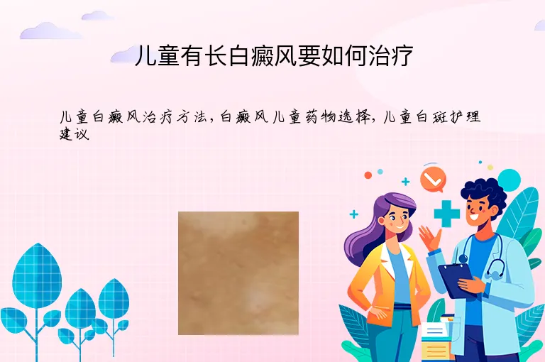 儿童有长白癜风要如何治疗