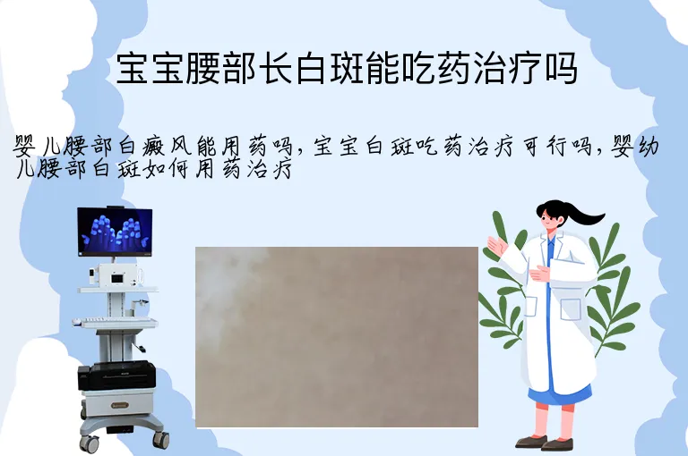宝宝腰部长白斑能吃药治疗吗