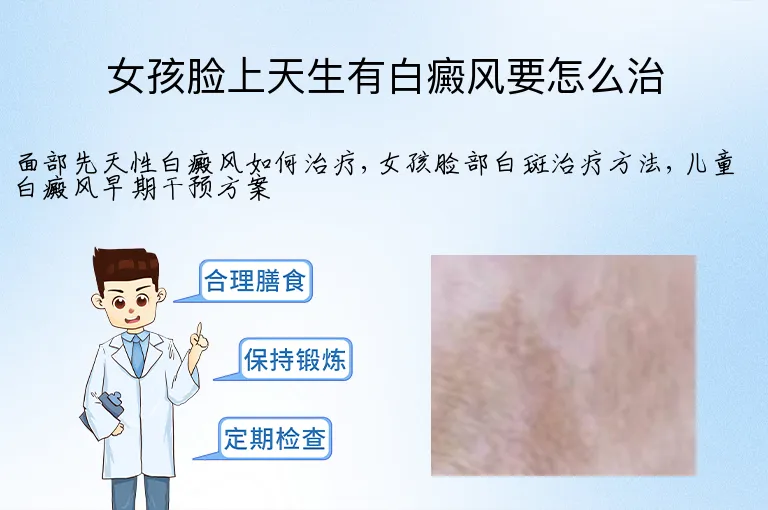 女孩脸上天生有白癜风要怎么治