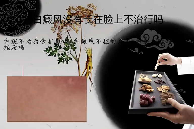 白癜风没有长在脸上不治行吗