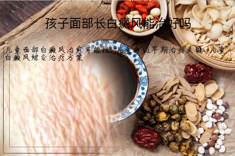 孩子面部长白癜风能治好吗
