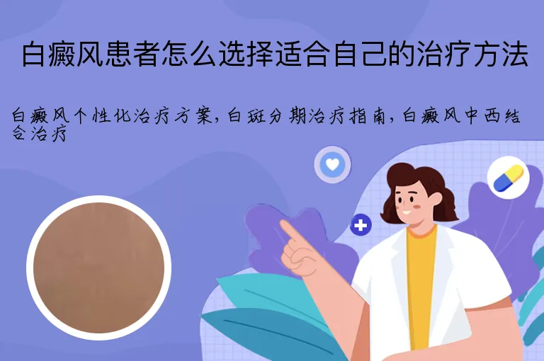 白癜风患者怎么选择适合自己的治疗方法