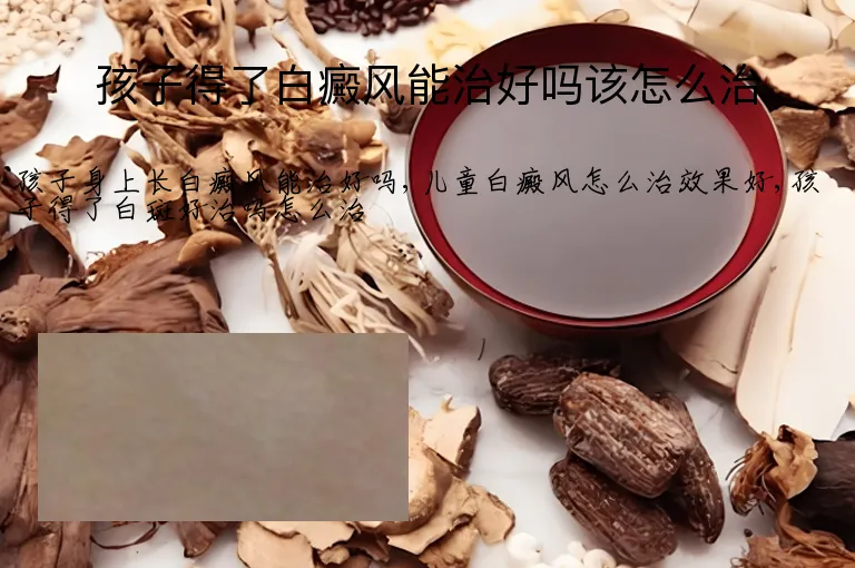 孩子得了白癜风能治好吗该怎么治
