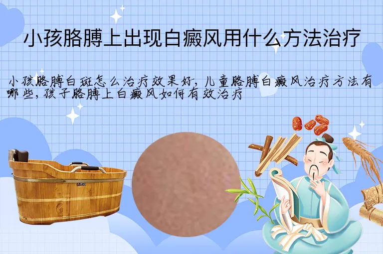 小孩胳膊上出现白癜风用什么方法治疗
