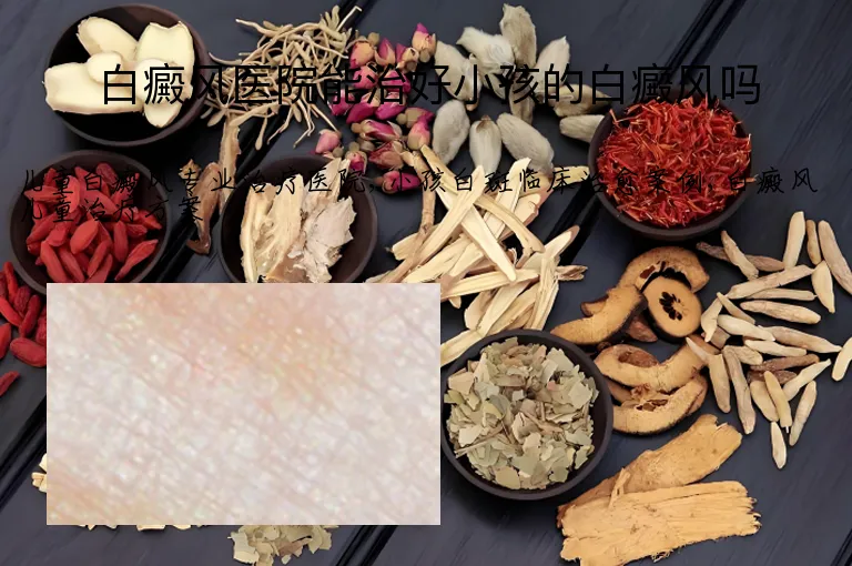 白癜风医院能治好小孩的白癜风吗