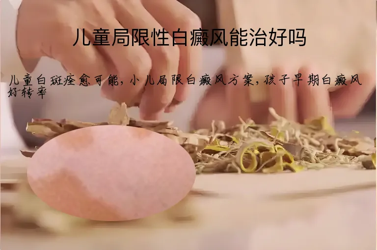 儿童局限性白癜风能治好吗
