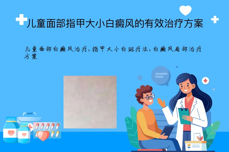 儿童面部指甲大小白癜风的有效治疗方案