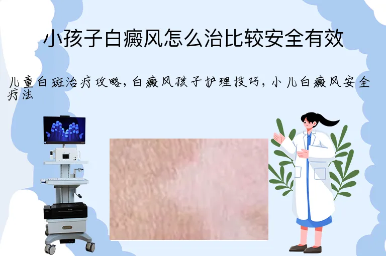 小孩子白癜风怎么治比较安全有效