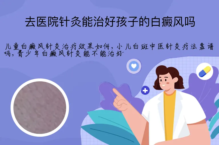 去医院针灸能治好孩子的白癜风吗