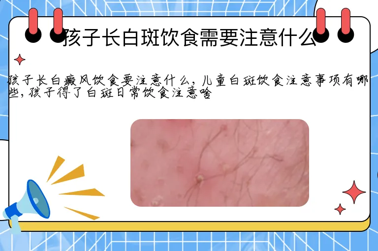孩子长白斑饮食需要注意什么