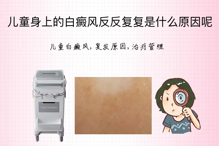 儿童身上的白癜风反反复复是什么原因呢