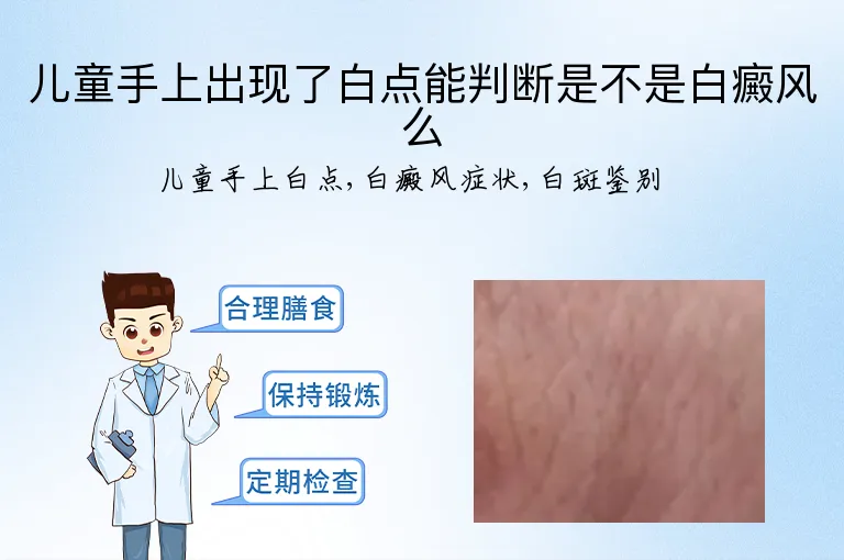 儿童手上出现了白点能判断是不是白癜风么