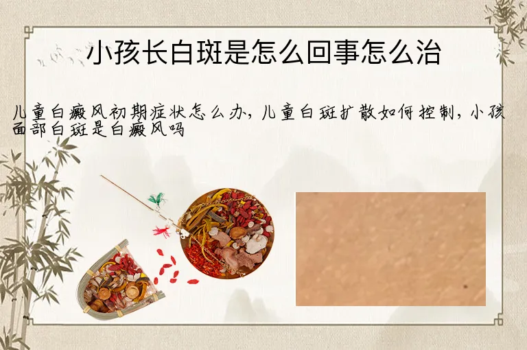 小孩长白斑是怎么回事怎么治