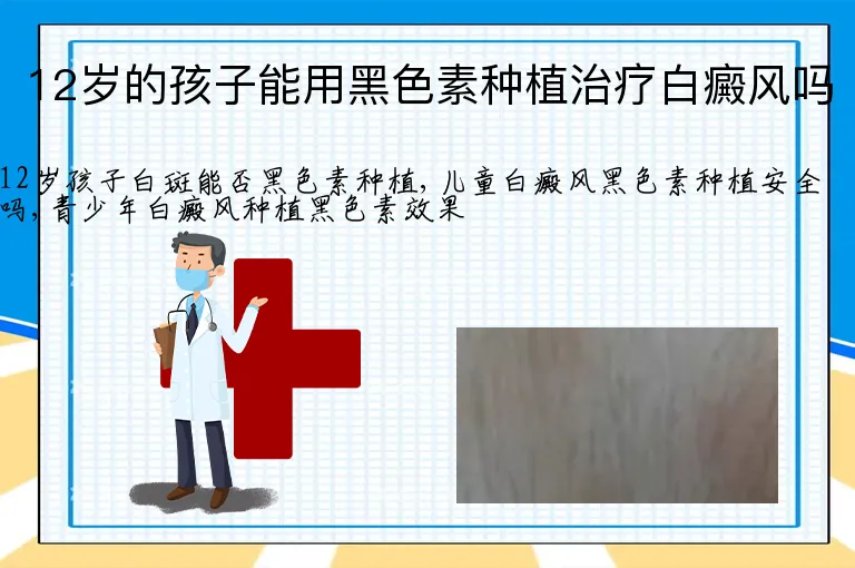 12岁的孩子能用黑色素种植治疗白癜风吗