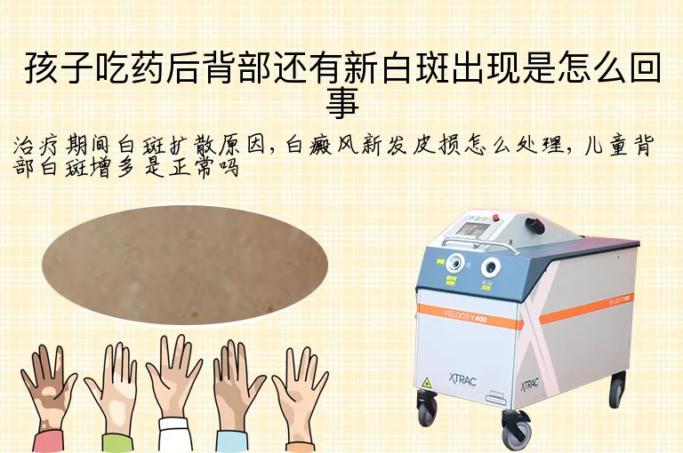 孩子吃药后背部还有新白斑出现是怎么回事