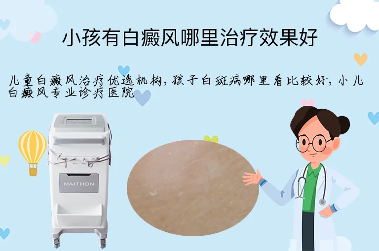 小孩有白癜风哪里治疗效果好