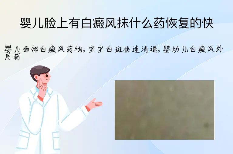婴儿脸上有白癜风抹什么药恢复的快