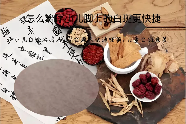 怎么治疗小儿脚上的白斑更快捷