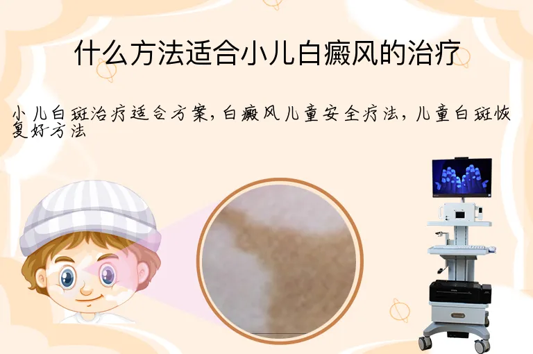 什么方法适合小儿白癜风的治疗