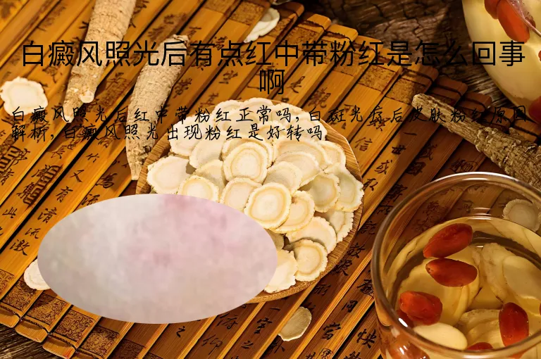 白癜风照光后有点红中带粉红是怎么回事啊