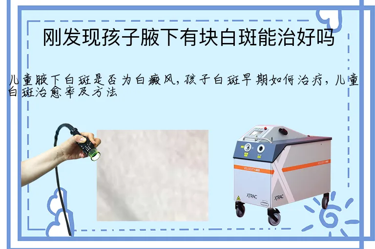 刚发现孩子腋下有块白斑能治好吗