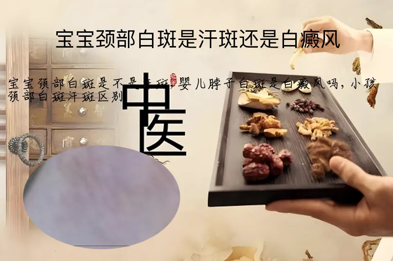 宝宝颈部白斑是汗斑还是白癜风
