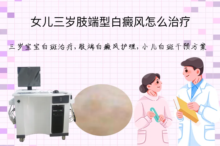 女儿三岁肢端型白癜风怎么治疗