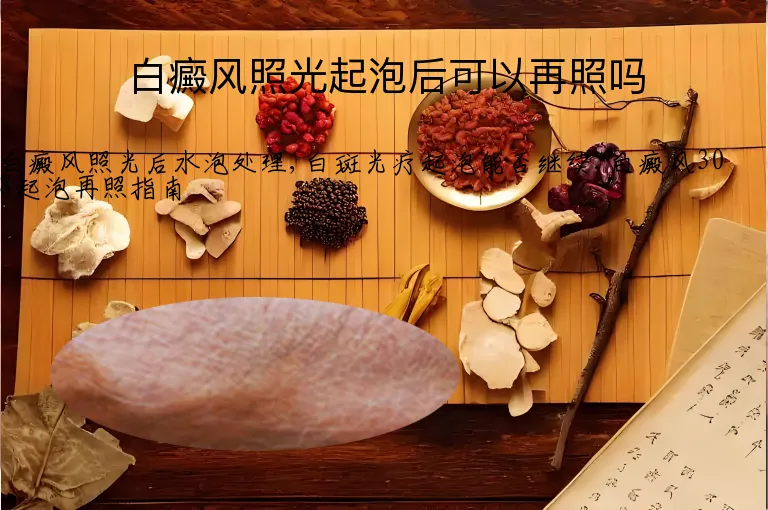 白癜风照光起泡后可以再照吗