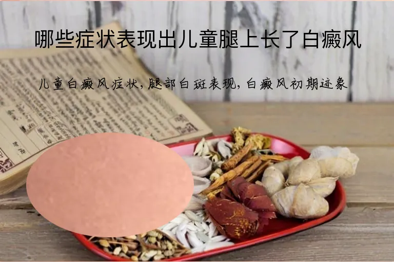 哪些症状表现出儿童腿上长了白癜风