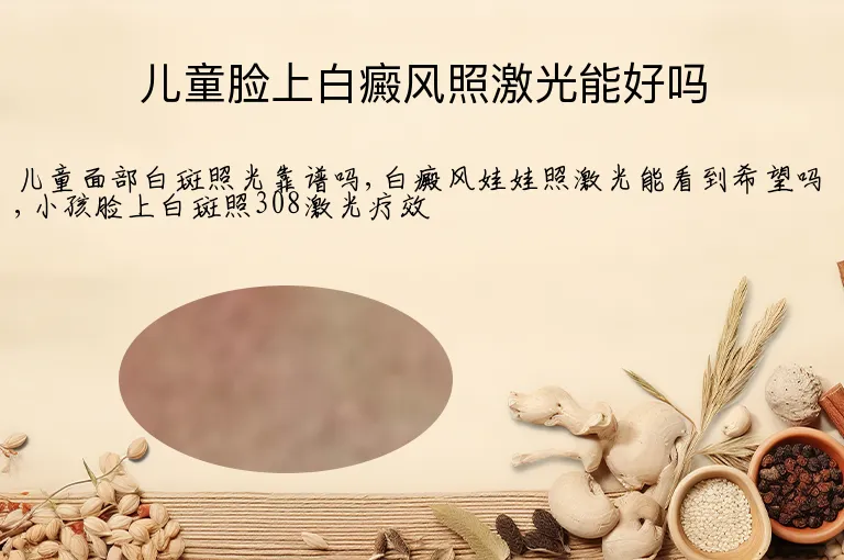 儿童脸上白癜风照激光能好吗