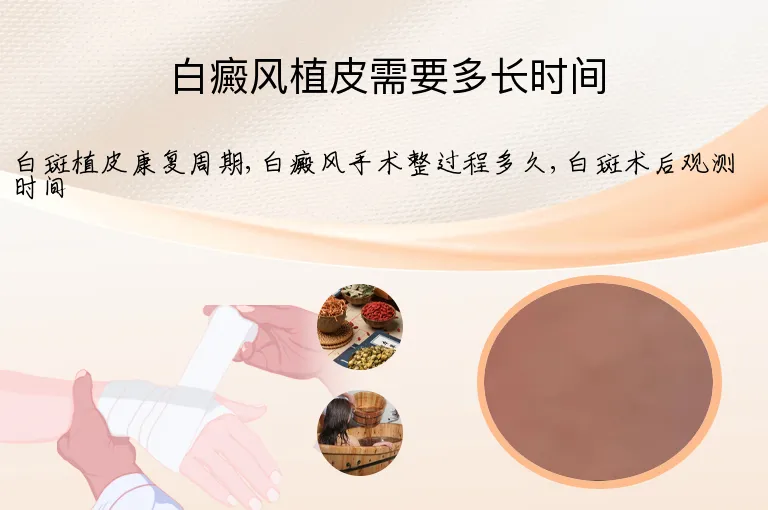 白癜风植皮需要多长时间