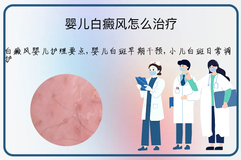 婴儿白癜风怎么治疗