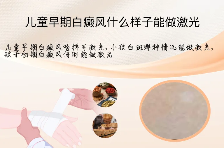 儿童早期白癜风什么样子能做激光