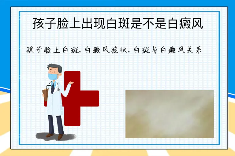 孩子脸上出现白斑是不是白癜风