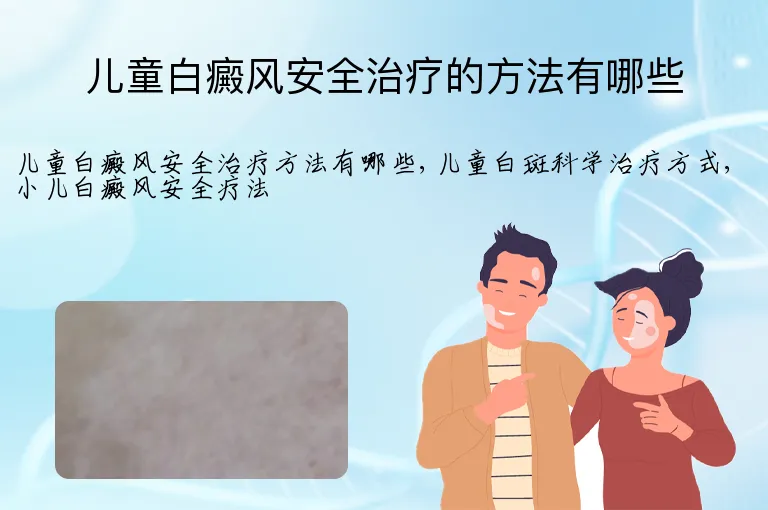 儿童白癜风安全治疗的方法有哪些